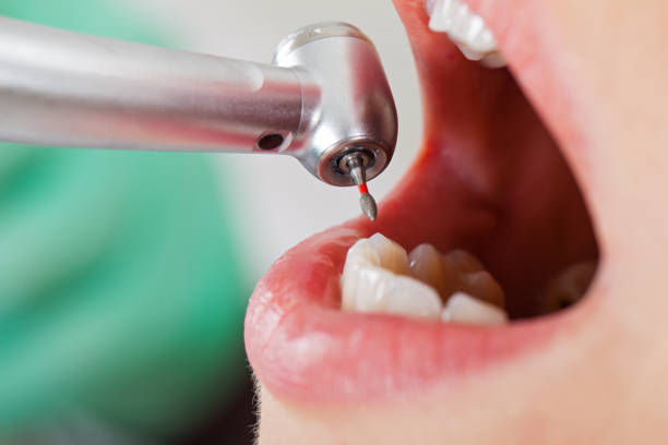 Best Emergency Tooth Extraction  in Emory, VA